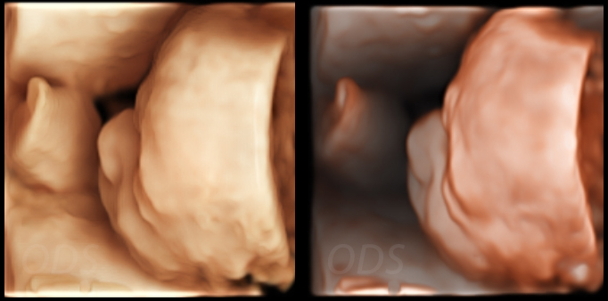 Surface and Depth Rendering