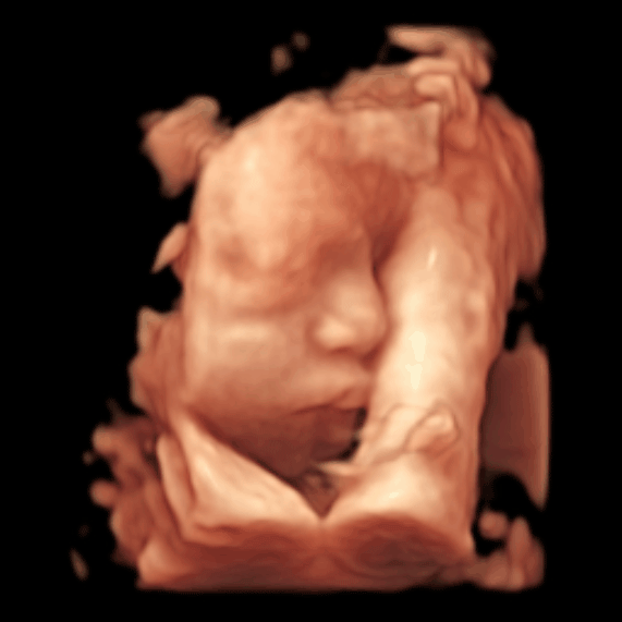 iClear3D image 1