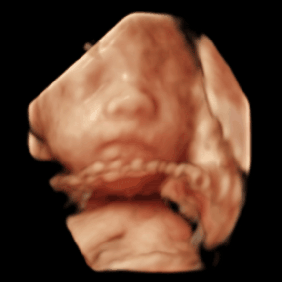 iClear3D image 2