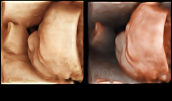 4D Gallery image