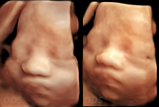 4D Gallery image