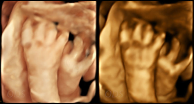 4D Gallery image