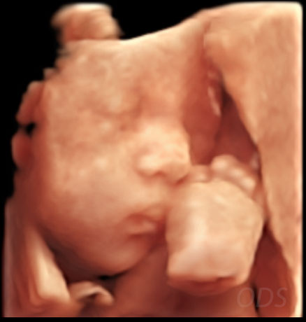 4D Gallery image