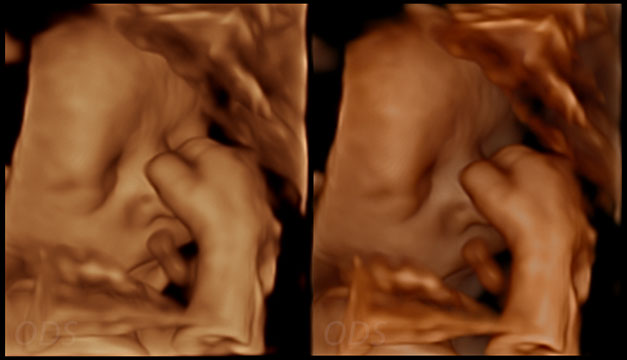 4D Gallery image