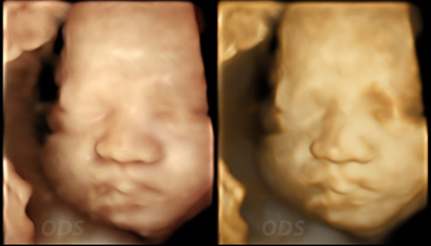 4D Gallery image