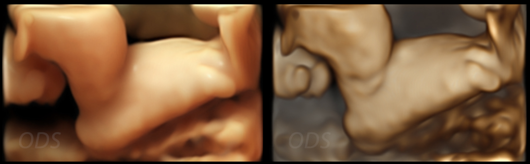 4D Gallery image