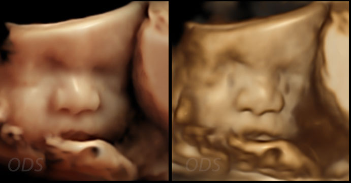 4D Gallery image