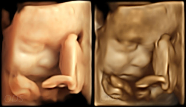4D Gallery image