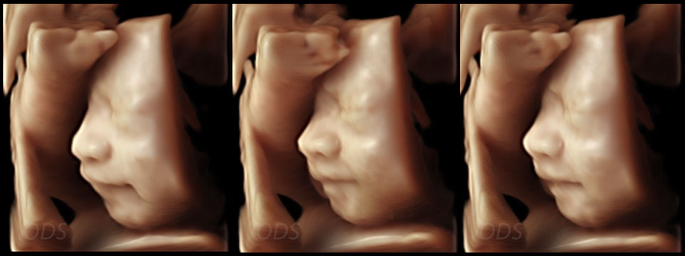 4D Gallery image