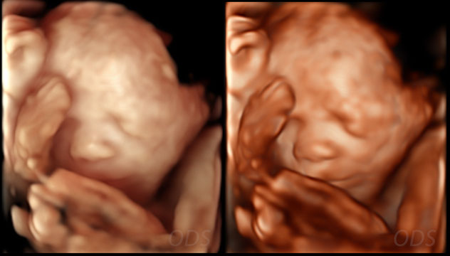 4D Gallery image