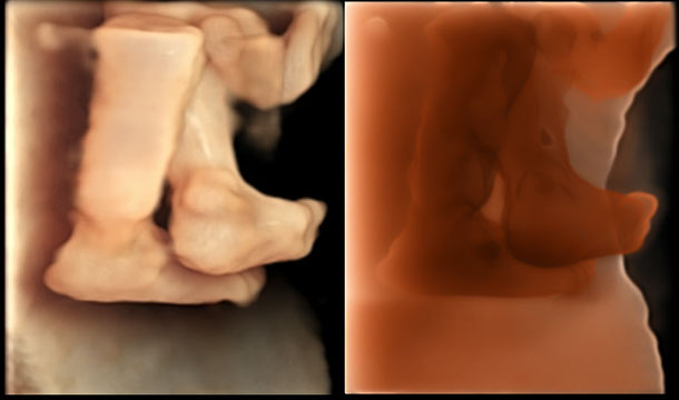 4D Gallery image