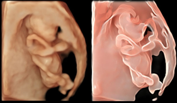 4D Gallery image