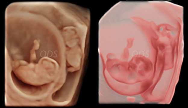 4D Gallery image