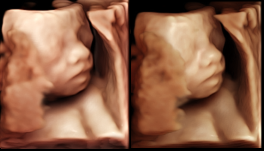4D Gallery image