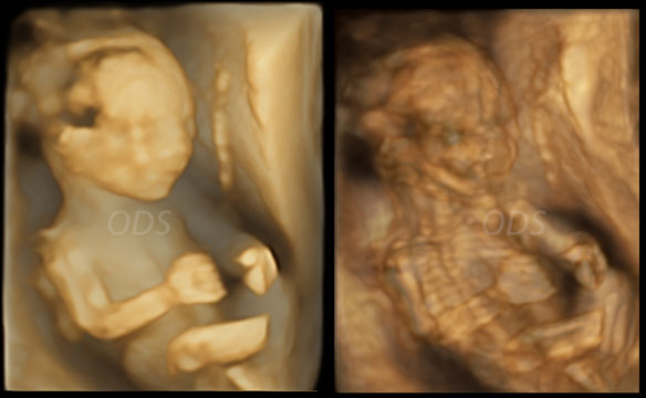 4D Gallery image