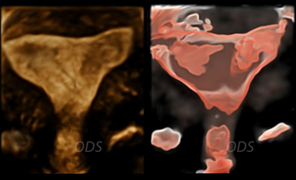 4D Gallery image