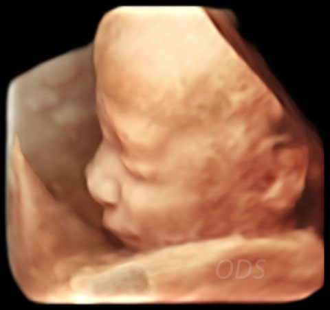 4D Gallery image