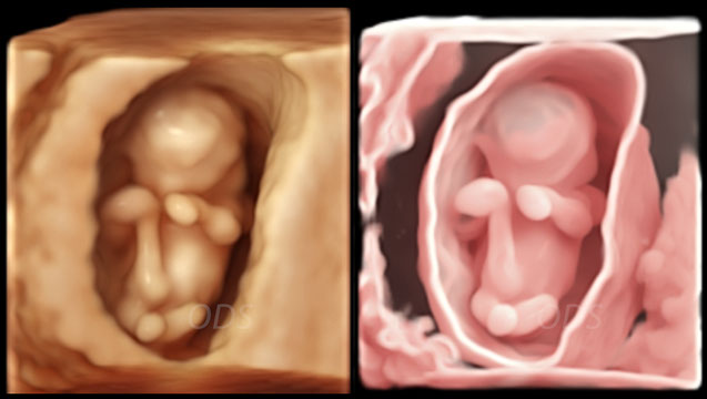 4D Gallery image