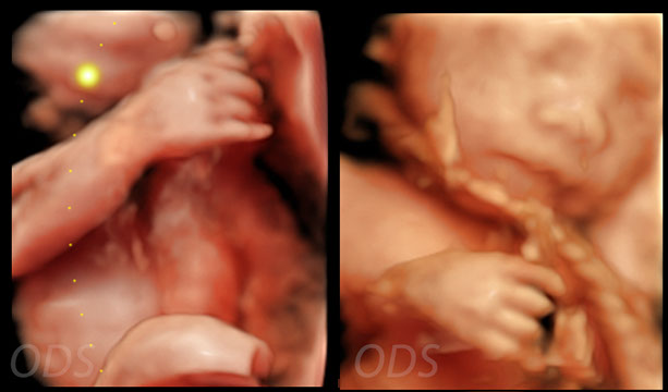 4D Gallery image
