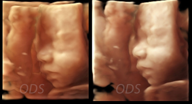 4D Gallery image