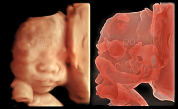 4D Gallery image