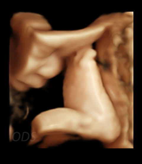 4D Gallery image