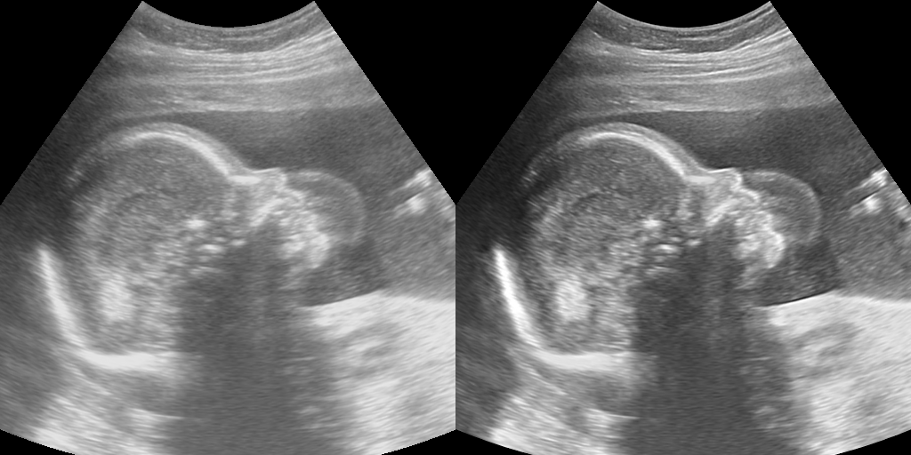 iClear Image 1