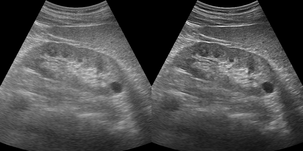 iClear Image 2
