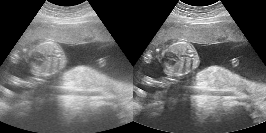 iClear Image 3