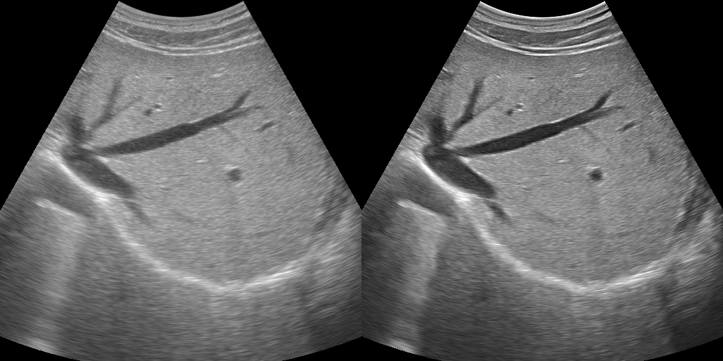 iClear Image 4