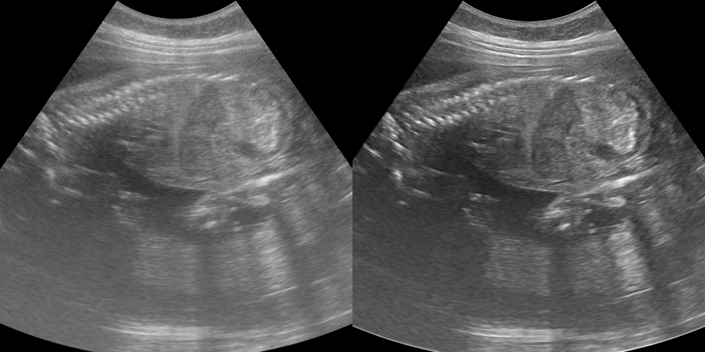 iClear Image 5