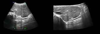 iPano Liver panorama