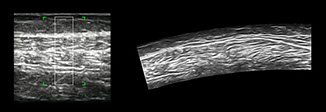 iPano Leg-long axis scan