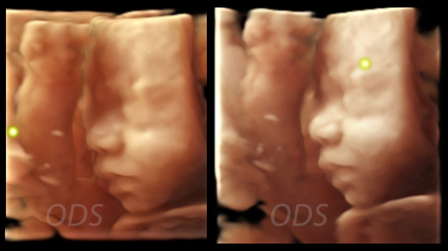 Realskin Rendering images